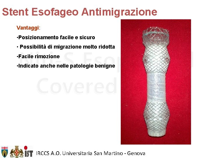 Stent Esofageo Antimigrazione Vantaggi: • Posizionamento facile e sicuro • Possibilità di migrazione molto