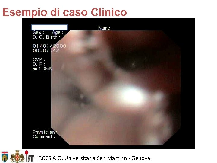 Esempio di caso Clinico IRCCS A. O. Universitaria San Martino - Genova 