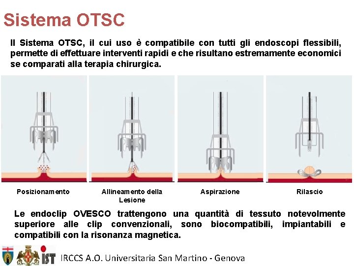 Sistema OTSC Il Sistema OTSC, il cui uso è compatibile con tutti gli endoscopi