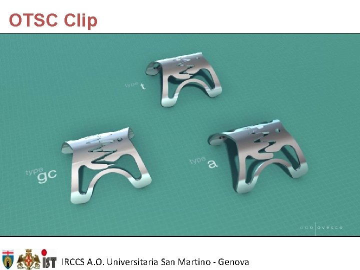 OTSC Clip IRCCS A. O. Universitaria San Martino - Genova 