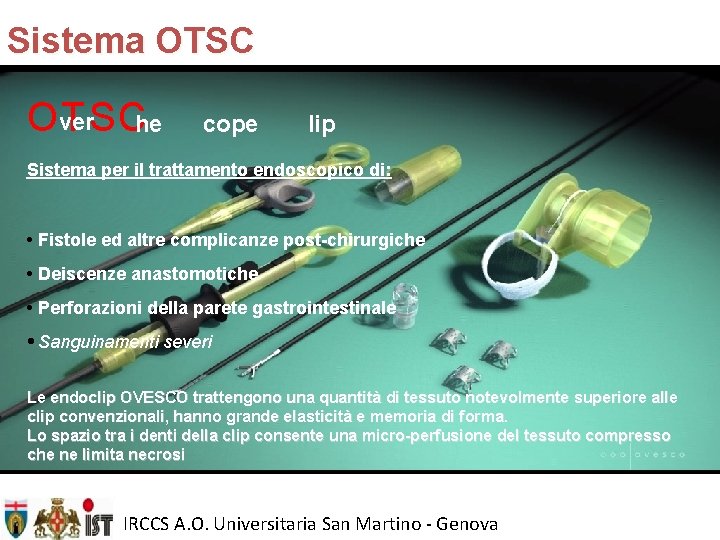 Sistema OTSC Over TS Che cope lip Sistema per il trattamento endoscopico di: •
