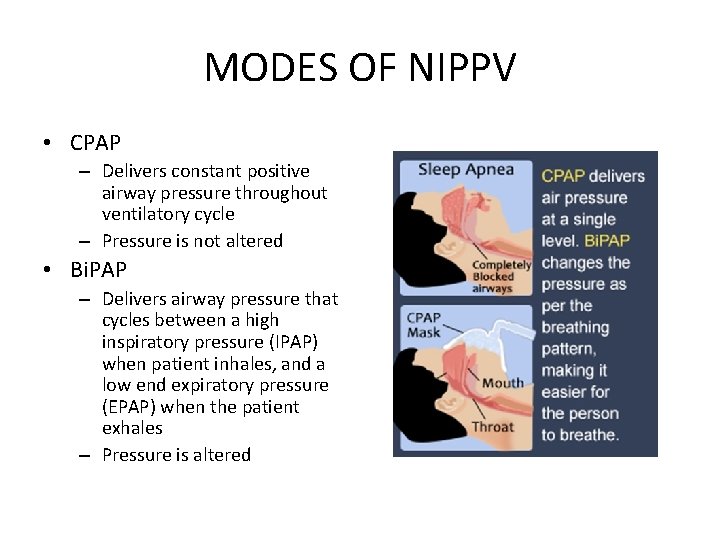 MODES OF NIPPV • CPAP – Delivers constant positive airway pressure throughout ventilatory cycle