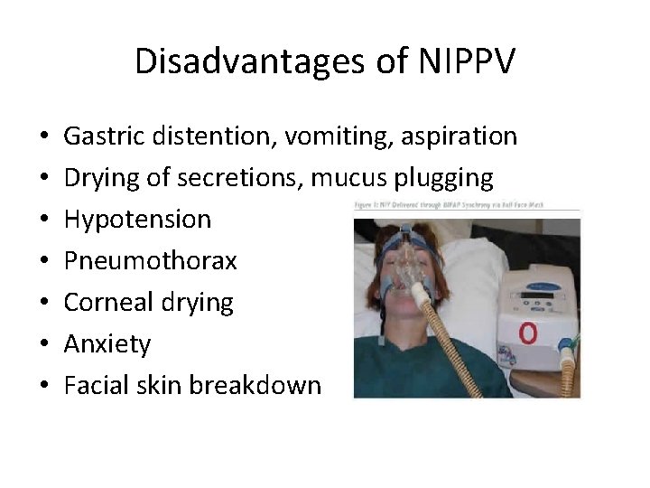 Disadvantages of NIPPV • • Gastric distention, vomiting, aspiration Drying of secretions, mucus plugging