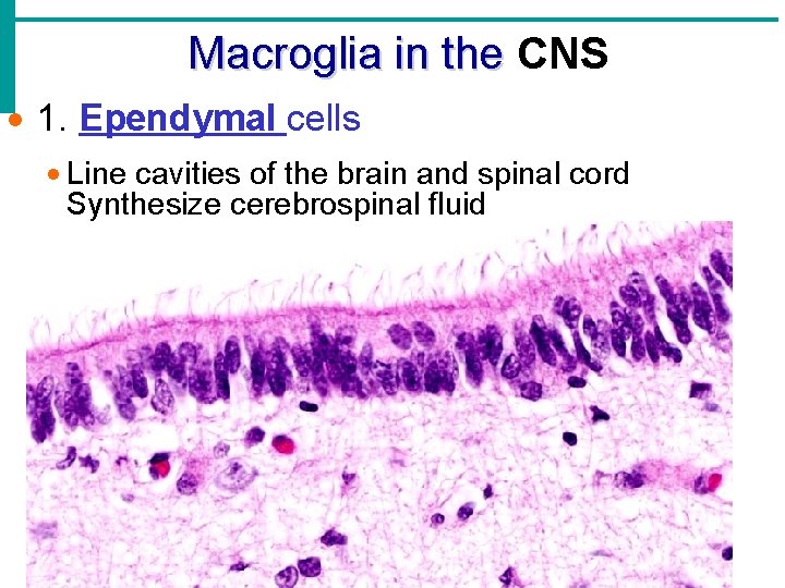 Macroglia in the CNS · 1. Ependymal cells · Line cavities of the brain Macroglia in the CNS · 1. Ependymal cells · Line cavities of the brain