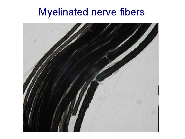 Myelinated nerve fibers Myelinated nerve fibers