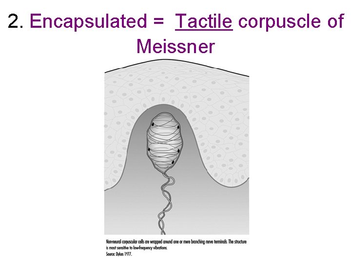 2. Encapsulated = Tactile corpuscle of Meissner 2. Encapsulated = Tactile corpuscle of Meissner