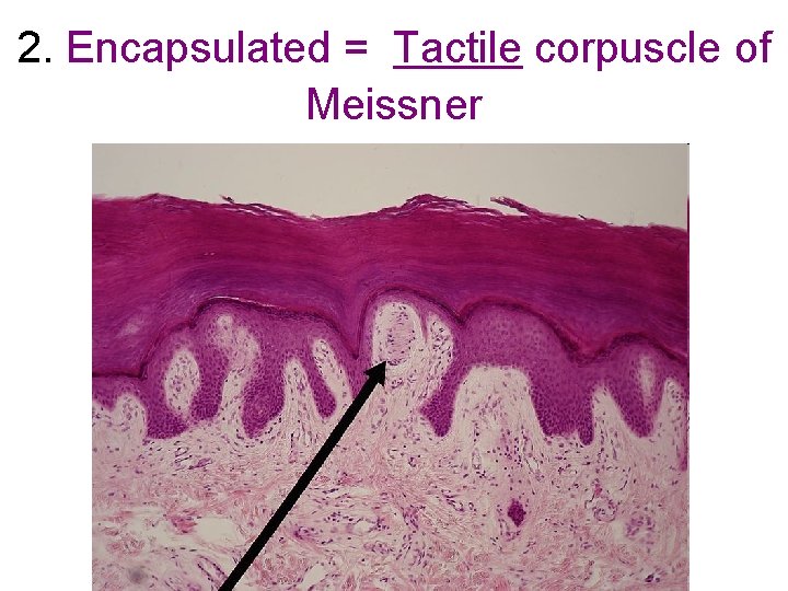 2. Encapsulated = Tactile corpuscle of Meissner 2. Encapsulated = Tactile corpuscle of Meissner