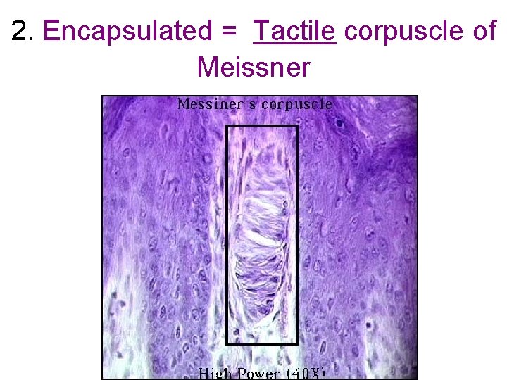 2. Encapsulated = Tactile corpuscle of Meissner 2. Encapsulated = Tactile corpuscle of Meissner