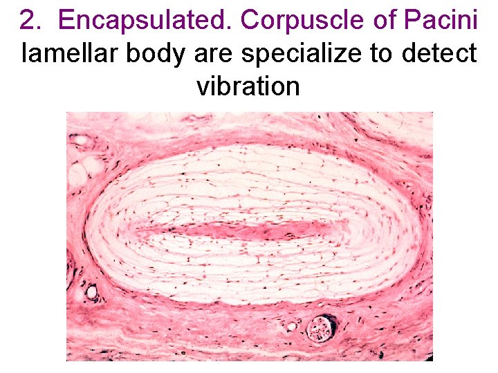 2. Encapsulated. Corpuscle of Pacini lamellar body are specialize to detect vibration 2. Encapsulated. Corpuscle of Pacini lamellar body are specialize to detect vibration