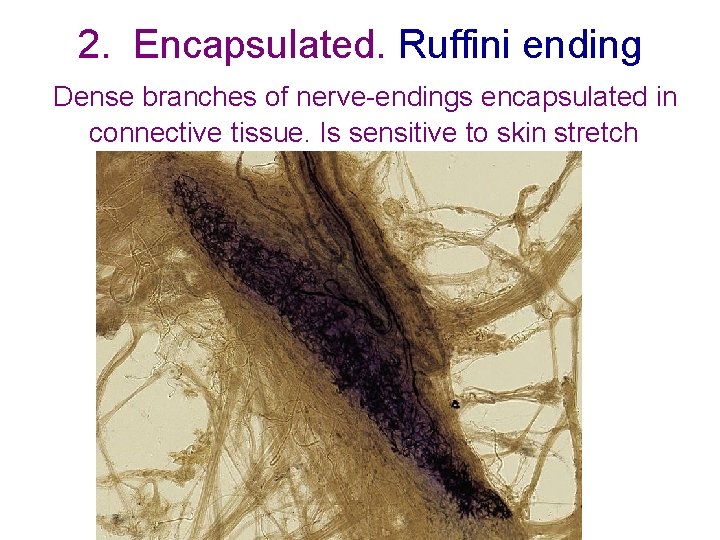 2. Encapsulated. Ruffini ending Dense branches of nerve-endings encapsulated in connective tissue. Is sensitive 2. Encapsulated. Ruffini ending Dense branches of nerve-endings encapsulated in connective tissue. Is sensitive