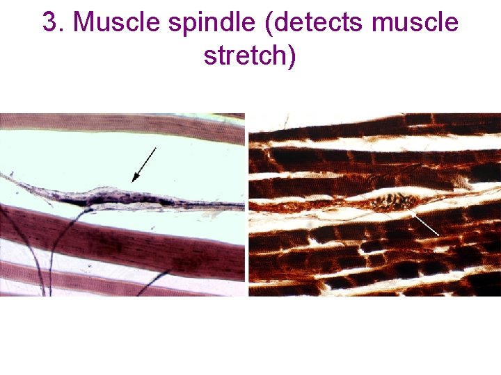 3. Muscle spindle (detects muscle stretch) 3. Muscle spindle (detects muscle stretch)