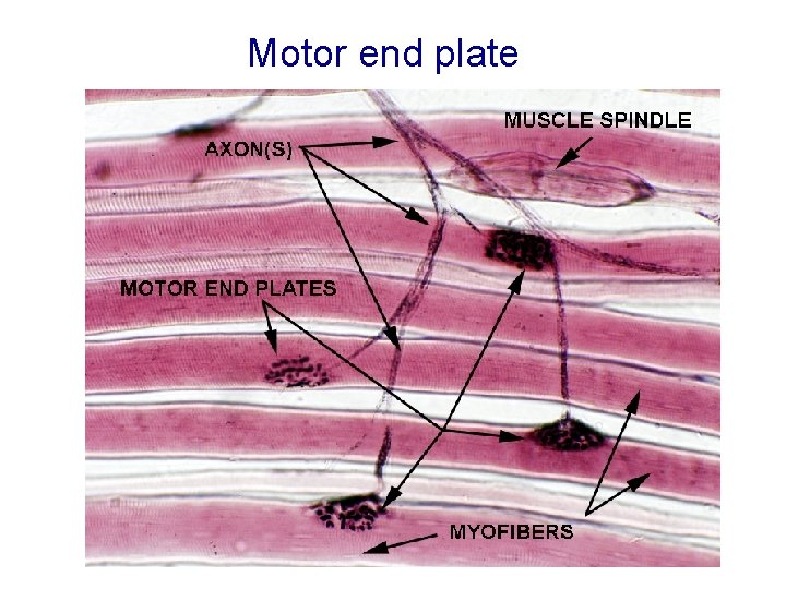 Motor end plate Motor end plate