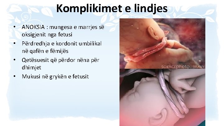 Komplikimet e lindjes • ANOKSIA : mungesa e marrjes së oksigjenit nga fetusi •