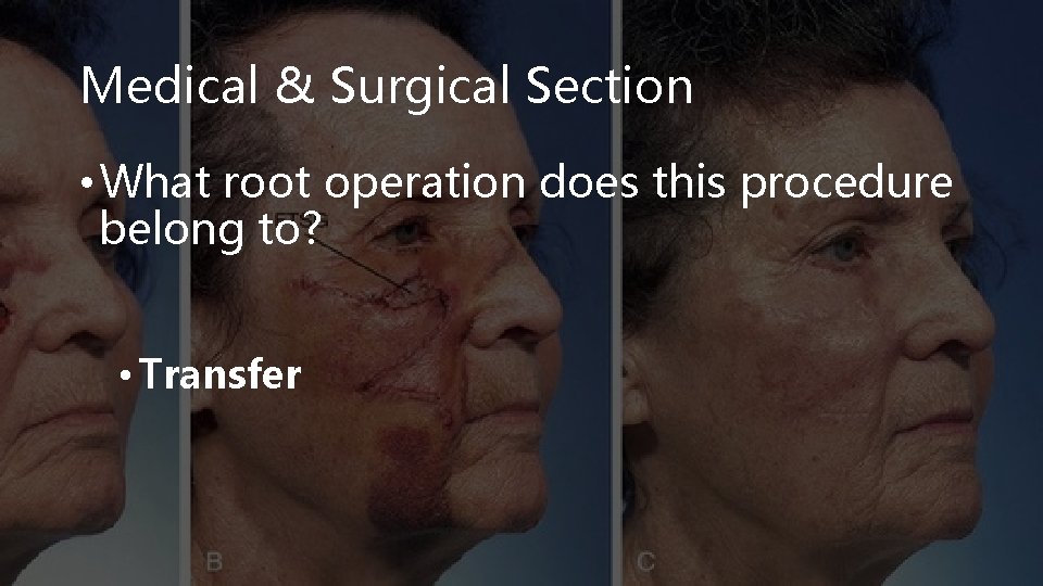 Medical & Surgical Section • What root operation does this procedure belong to? •