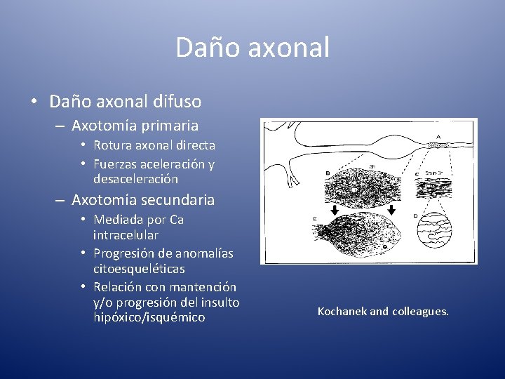 Daño axonal • Daño axonal difuso – Axotomía primaria • Rotura axonal directa •