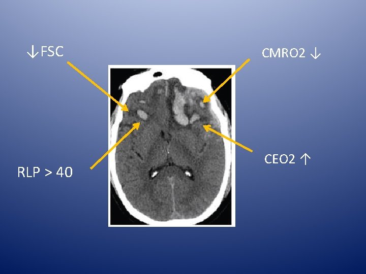 ↓FSC RLP > 40 CMRO 2 ↓ CEO 2 ↑ 