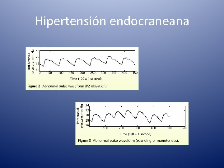 Hipertensión endocraneana 