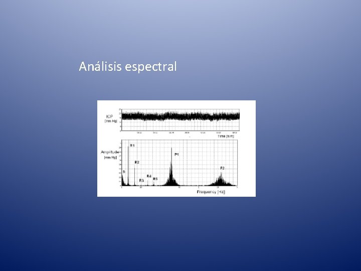 Análisis espectral 