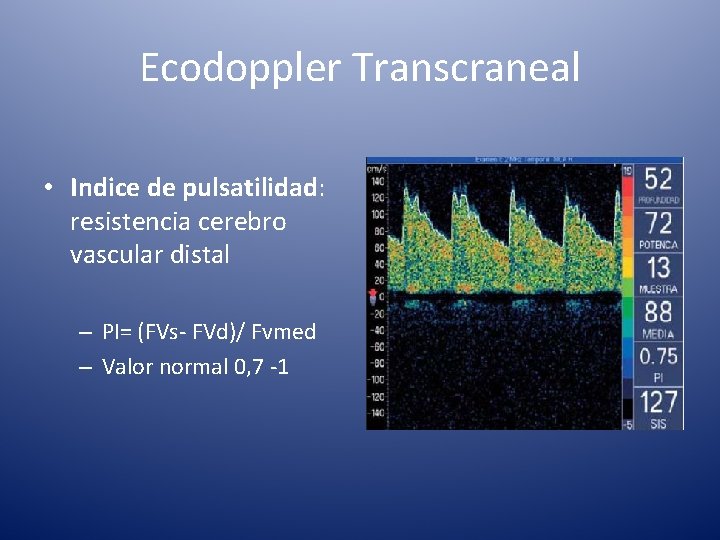 Ecodoppler Transcraneal • Indice de pulsatilidad: resistencia cerebro vascular distal – PI= (FVs- FVd)/