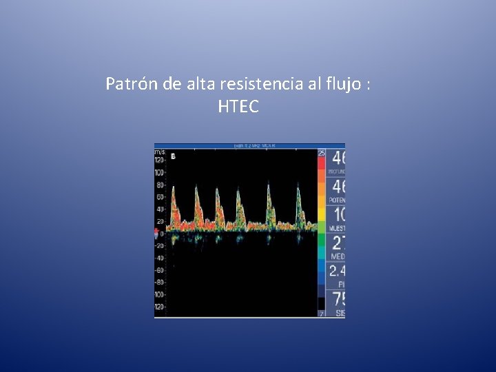Patrón de alta resistencia al flujo : HTEC 