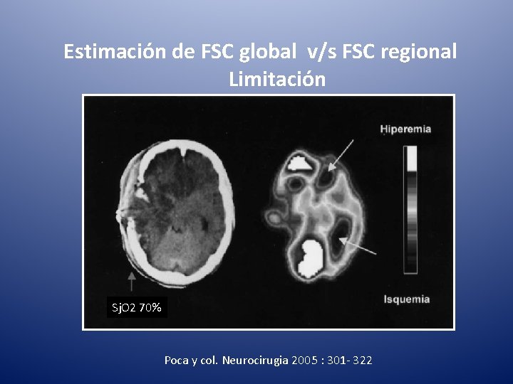 Estimación de FSC global v/s FSC regional Limitación Sj. O 2 70% Poca y