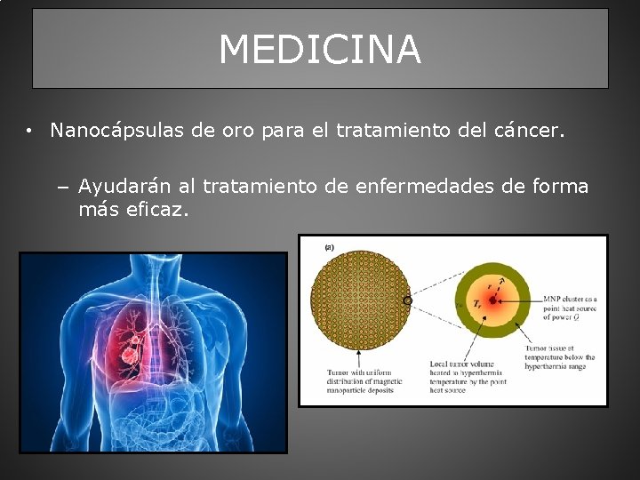 MEDICINA • Nanocápsulas de oro para el tratamiento del cáncer. – Ayudarán al tratamiento