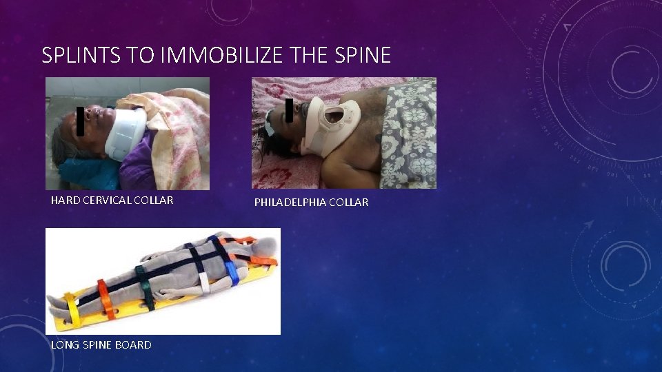 SPLINTS TO IMMOBILIZE THE SPINE HARD CERVICAL COLLAR LONG SPINE BOARD PHILADELPHIA COLLAR 