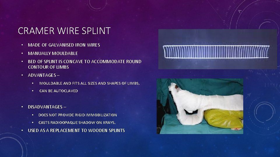 CRAMER WIRE SPLINT • MADE OF GALVANISED IRON WIRES • MANUALLY MOULDABLE • BED