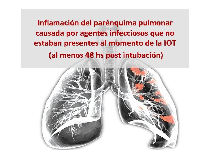 Inflamación del parénquima pulmonar causada por agentes infecciosos que no estaban presentes al momento