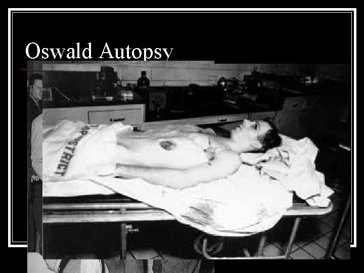 Oswald Autopsy 