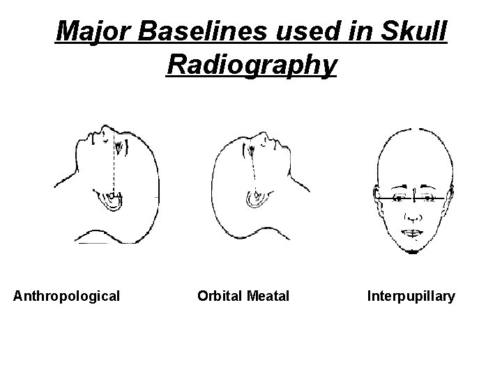 Major Baselines used in Skull Radiography Anthropological Orbital Meatal Interpupillary 