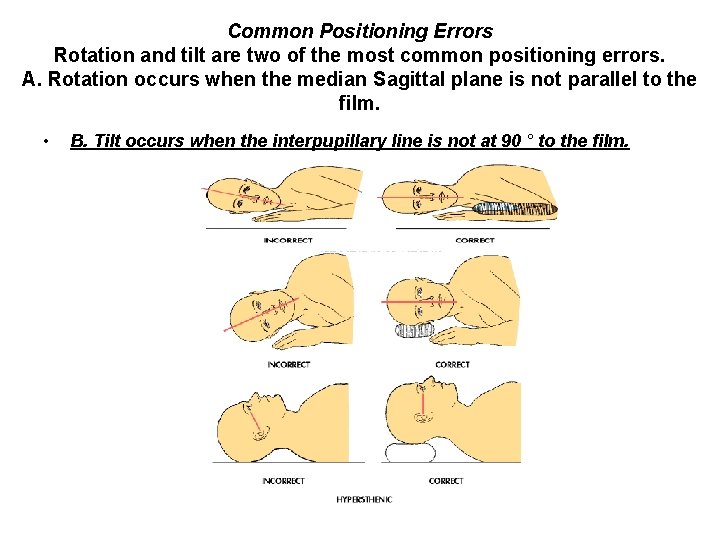 Common Positioning Errors Rotation and tilt are two of the most common positioning errors.