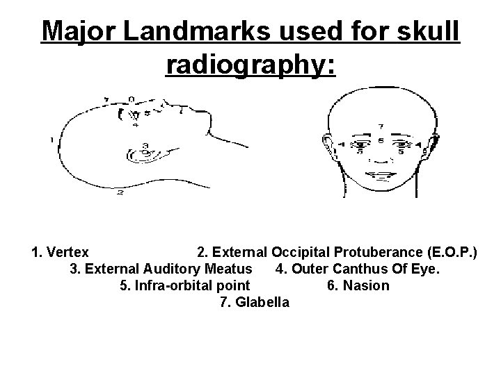 Major Landmarks used for skull radiography: 1. Vertex 2. External Occipital Protuberance (E. O.