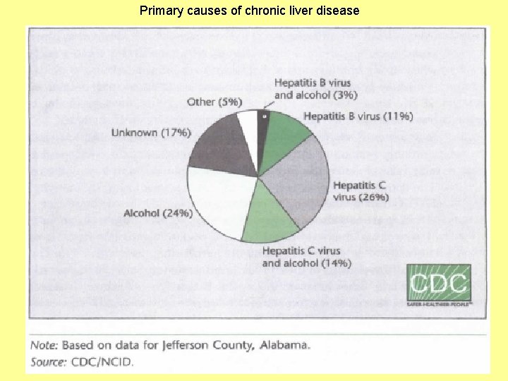 Primary causes of chronic liver disease 