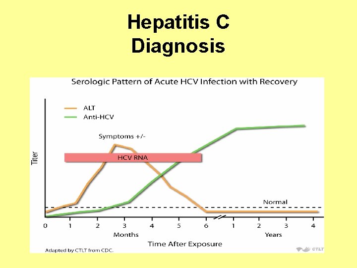 Hepatitis C Diagnosis 