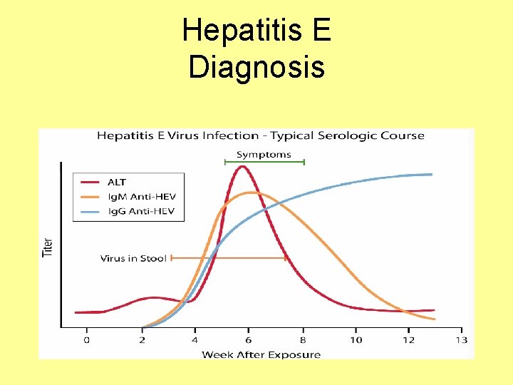 Hepatitis E Diagnosis 