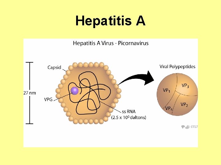 Hepatitis A 