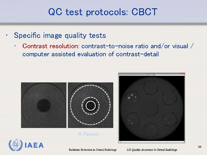 QC test protocols: CBCT • Specific image quality tests • Contrast resolution: contrast-to-noise ratio