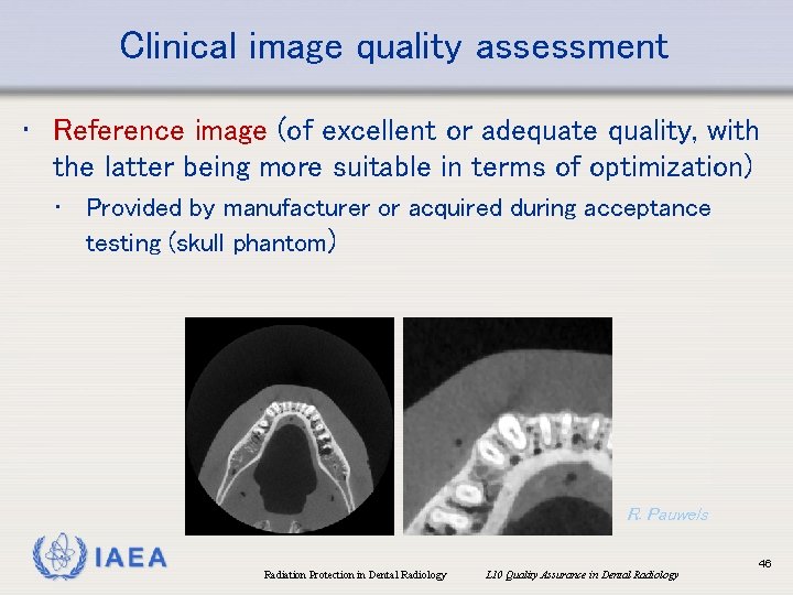 Clinical image quality assessment • Reference image (of excellent or adequate quality, with the