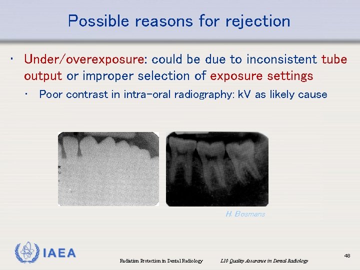 Possible reasons for rejection • Under/overexposure: could be due to inconsistent tube output or