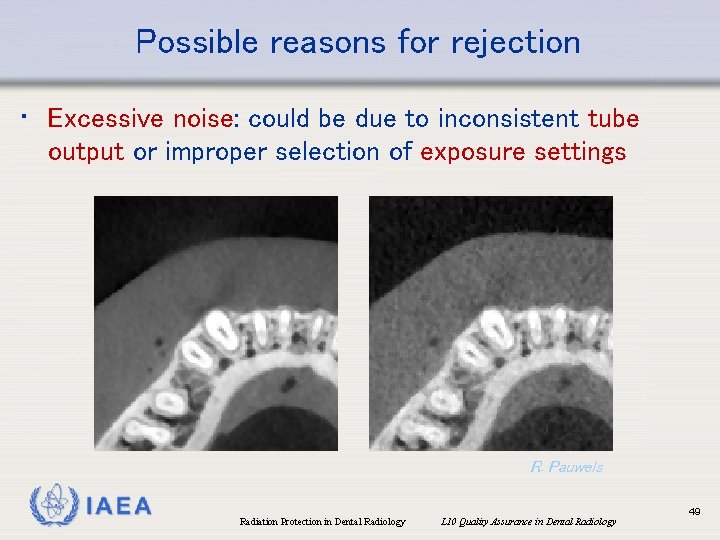 Possible reasons for rejection • Excessive noise: could be due to inconsistent tube output