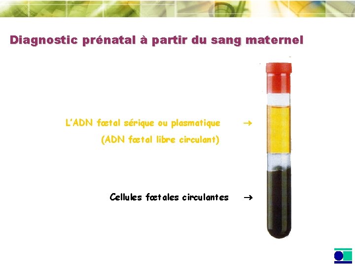 Diagnostic prénatal à partir du sang maternel L’ADN fœtal sérique ou plasmatique (ADN fœtal Diagnostic prénatal à partir du sang maternel L’ADN fœtal sérique ou plasmatique (ADN fœtal