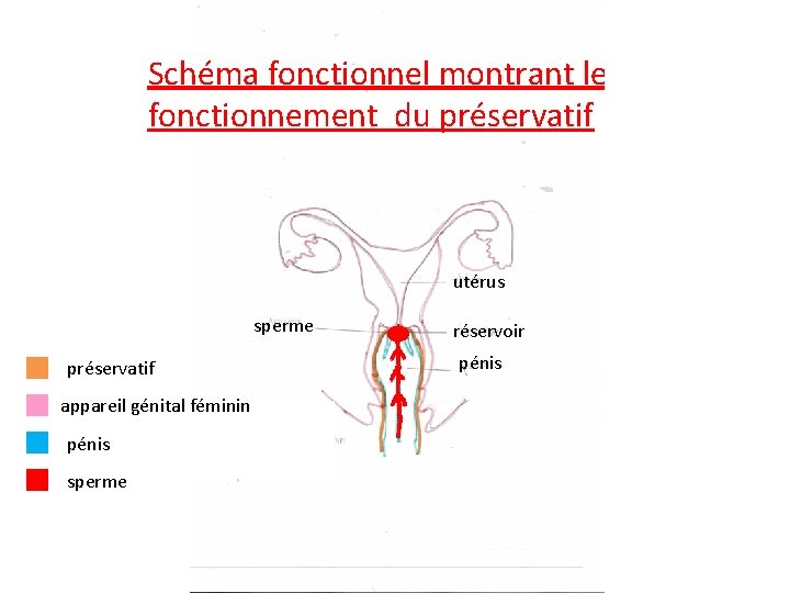 Schéma fonctionnel montrant le fonctionnement du préservatif utérus sperme préservatif appareil génital féminin pénis