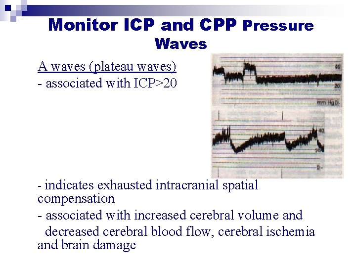 Monitor ICP and CPP Pressure Waves A waves (plateau waves) - associated with ICP>20 Monitor ICP and CPP Pressure Waves A waves (plateau waves) - associated with ICP>20