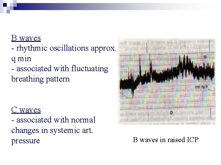 B waves - rhythmic oscillations approx. q min - associated with fluctuating breathing pattern B waves - rhythmic oscillations approx. q min - associated with fluctuating breathing pattern