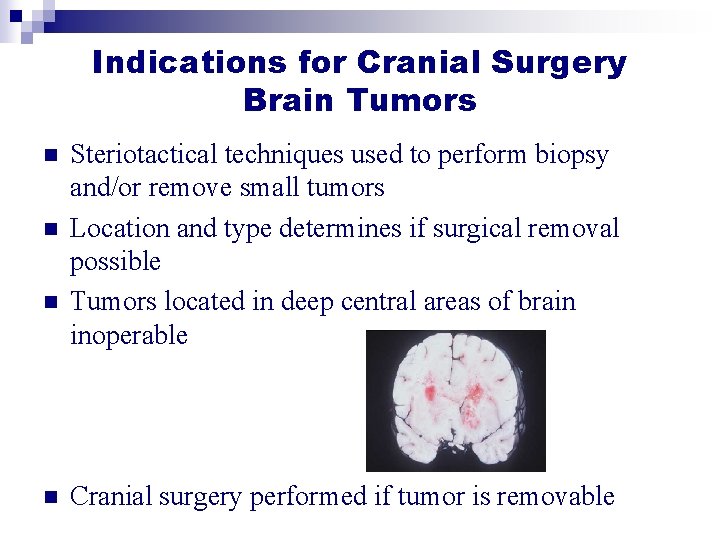 Indications for Cranial Surgery Brain Tumors n n Steriotactical techniques used to perform biopsy Indications for Cranial Surgery Brain Tumors n n Steriotactical techniques used to perform biopsy