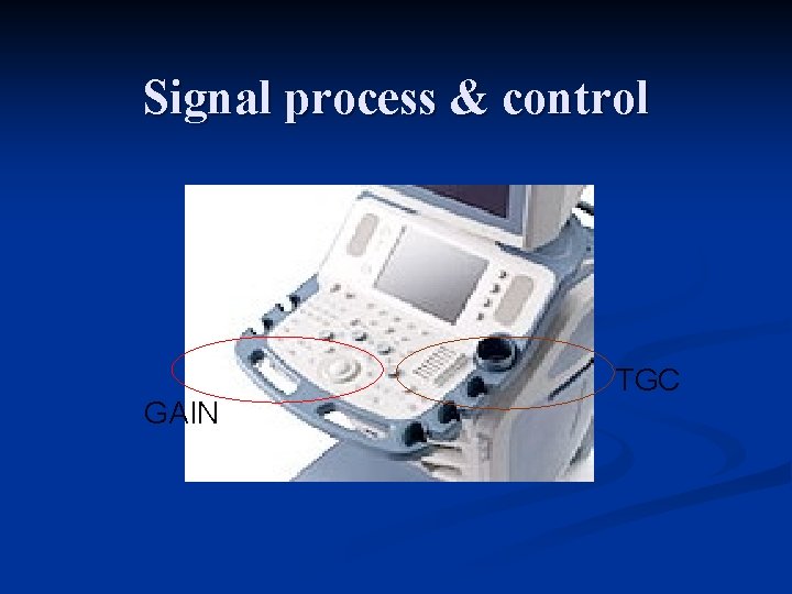 Signal process & control GAIN TGC 