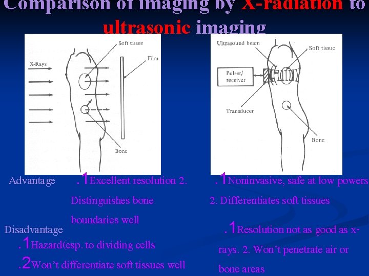 Comparison of imaging by X-radiation to ultrasonic imaging Advantage . 1 Excellent resolution 2.