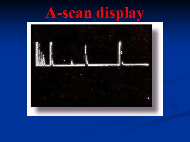 A-scan display 