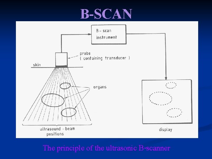 B-SCAN The principle of the ultrasonic B-scanner 